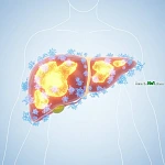 解讀肝酵素 ALT 與 AST