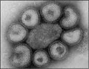 H1N1型流感病毒