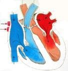 heartstream