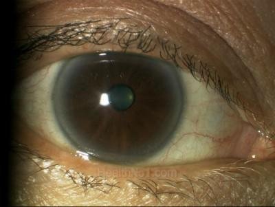 eyeschk03