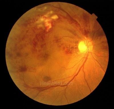eyeschk04