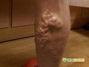 時間到了就換姿勢　不怕小蚯蚓爬滿腿