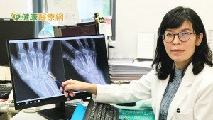 老婦莫名暴瘦　竟因類風濕性關節炎惹禍！