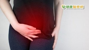 女性肌瘤如何切除？　婦科醫師告訴你現行處置方式
