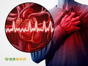 嚴重血管鈣化成隱憂　旋磨術降堵塞風險