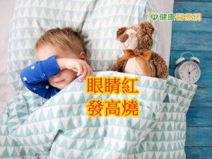 5歲男童發燒1週 川崎氏症作祟