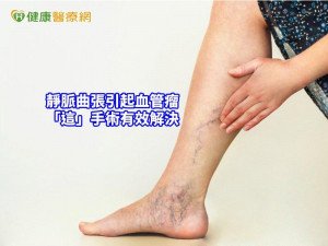 長如雞蛋大小肉瘤，連站立都疼痛　靜脈膠水救了她